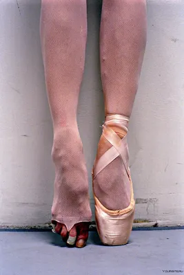 Почему у балерин растут косточки на ногах? | Всем балет! | Дзен