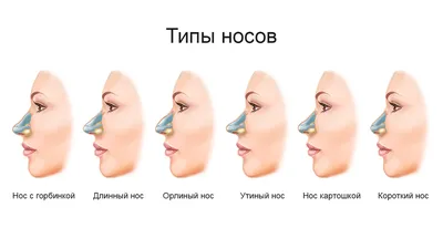 Уменьшение носа - Медицинский центр «ЗДОРОВЬЕ»
