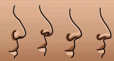 Что форма носа может рассказать о вашем характере и судьбе