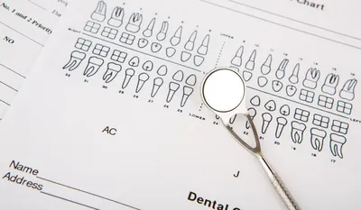Мезиализация всех нижних зубов при компенсации II класса - интересно об  ортодонтии, имплантации и протезировании зубов