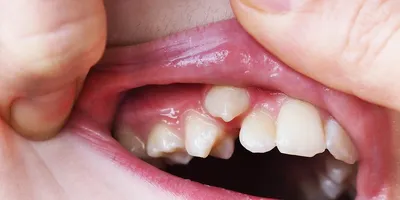 Плакат для стоматологии «Как устроены ваши зубы» — Магазин стоматологических  плакатов Stomanet.ru