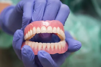 Аномалии зубов: краткая классификация