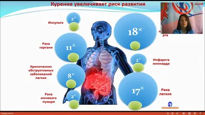 Курить - здоровью вредить - 1-я городская детская поликлиника