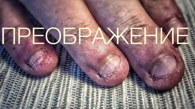 Материал для наращивания не портит ноготь! | ВКонтакте