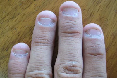 Маникюр на сгрызенные ногти (65 фото)