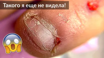 Ответы Mail.ru: Как отучиться грызть ногти? ничего не помогает. Мама ругает  что я грызу ногти, да так, что аж в кровь! Помогите.
