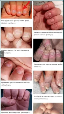 Ответы Mail.ru: Обгрызанные ногти ( фото)