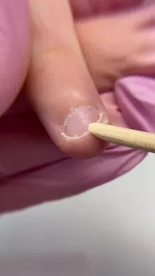 Привычка грызть ногти: как перестать | theGirl