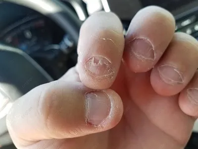 Привычка грызть ногти: как перестать | theGirl