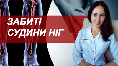 Облитерирующий эндартериит — лечение.. Клиника Позвоночника доктора  Разумовского в СПБ, записать онлайн