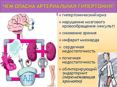 Медицинский центр здоровья опорно-двигательной системы «Академия Движения»  - Артриты и артрозы