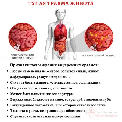 МРТ органов брюшной полости в Киеве — Цена от 1700 грн — 1,5 Тесла