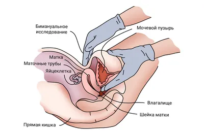 Как подготовиться к первому походу к гинекологу - Горящая изба