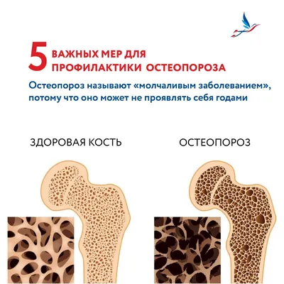 20 октября отмечается Всемирный день остеопороза