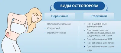 Что такое остеопороз? | Официальный сайт Александровского муниципального  округа Пермского края