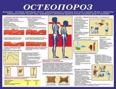 Остеопороз у женщин: методы, способы и средства лечения остеопороза