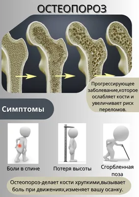 16-22 октября 2023г.: неделя профилактики остеопороза | Официальный сайт  государственного бюджетного учреждения здравоохранения «Выборгская  межрайонная больница»