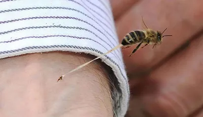 Укус пчелы, осы или шершня. Как правильно оказать первую помощь - BasTV