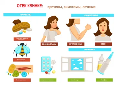 Лечение ангионевротического отёка или отёка Квинке в Москве в отделении  аллергологии клиники ИАКИ