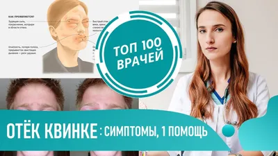 Дава пожаловался на аллергическую реакцию - Газета.Ru | Новости