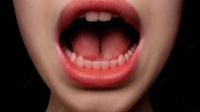Открытый рот со сломанными больными зубами и Periodontitis костоедой  затрагиваемыми. Стальной штифт в десны для установки зубного Стоковое Фото  - изображение насчитывающей нерв, заболевание: 172179240
