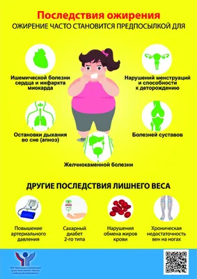 Ожирение — Школа здоровья — ГБУЗ Городская поликлиника 25 г. Краснодара МЗ  КК