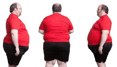 Ожирение — это болезнь бедных людей» – Коммерсантъ FM