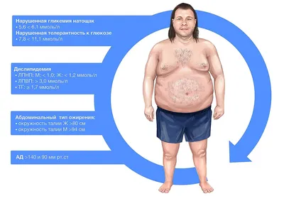 Ожирение 4 степени: сколько КГ/ИМТ и как людям с этим жить