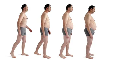 Ожирение усложняет лечение сердечных заболеваний - Национальная  бариатрическая практика