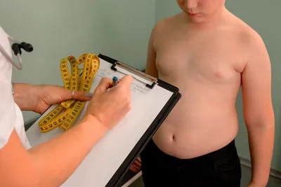 Ожирение: степени, типы, причины, диагностика и профилактика