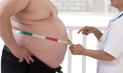 Ожирение может передаваться по наследству: генетические факторы и причины  риска | РБК Life