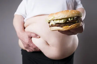 Ожирение назвали неинфекционной пандемией 21 века | Саратов 24