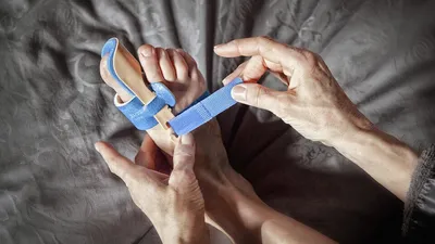 Перелом пальца руки: упражнения - Реабилитолог Остеопат Максим Поддуев  (Киев)
