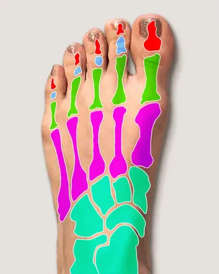 Перелом пальца на ноге: симптомы, лечение, профилактика в домашних условиях