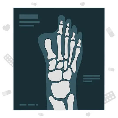 Стенозирующий лигаментит: причины и лечение, синдром щелкающего пальца на  руке у взрослого | Клиника Temed