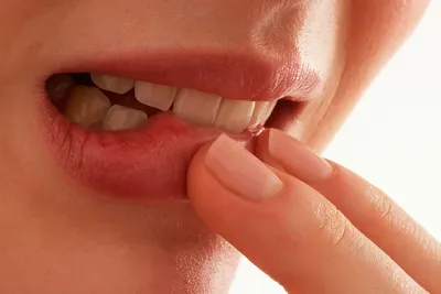 Пародонтоз – статьи стоматологической клиники «Medical Star»