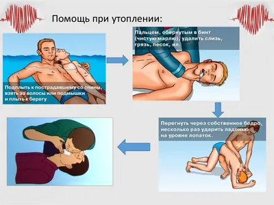 Первая помощь при утоплении: как действовать в воде и после извлечения  пострадавшего