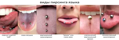 Пирсинг языка и зубы ⠀ На фото к... - Ортодонт Нана Гезалова | Facebook