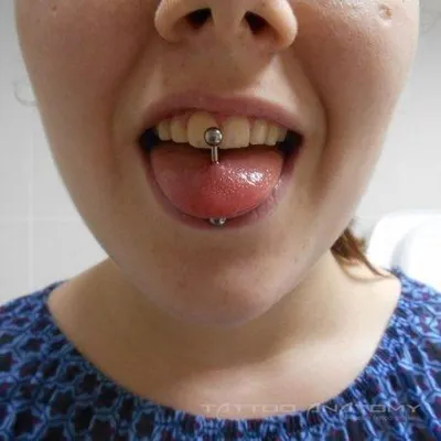 Вредит ли пирсинг на языке зубам - сколы и потеря зубов из-за пирсинга