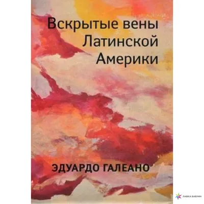 Вены: истории из жизни, советы, новости, юмор и картинки — Лучшее | Пикабу