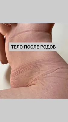 Блогерша показала страшные изменения тела после родов: Явления: Ценности:  Lenta.ru