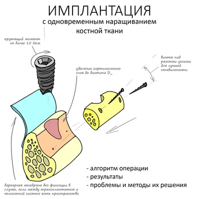 Десятый месяц войны России против Украины (ГЛАВНОЕ)