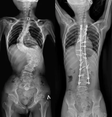 Анатомия - Позвоночник человека 3 3D Модель $29 - .unknown .blend .fbx .obj  - Free3D