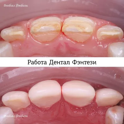 Сложное удаление зуба (3757) - Веселые картинки - фотогалерея -  Профессиональный стоматологический портал (сайт) «Клуб стоматологов»