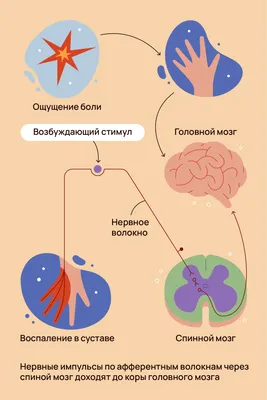 Головная боль: Причины Возникновения, Лечение в Киеве – Клиника Современной  Неврологии «Аксимед»