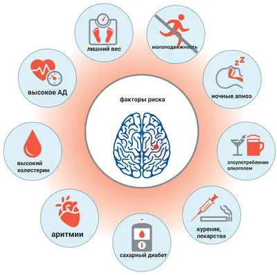 Факторы риска и профилактика инсульта — ГБУЗ Московской области  \"Долгопрудненская больница\"