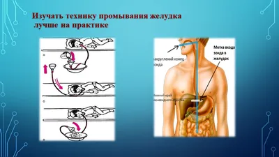 Фантом промывания желудка (DM-NS6037)