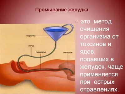 Катетер желудочный INEKTA с РКП CH20 110 см, 20 шт/уп - купить с доставкой  по выгодным ценам в интернет-магазине OZON (642316068)