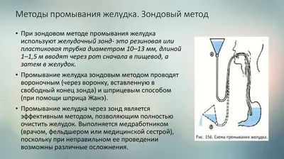 Зонд желудочный для забора секрета и промывания желудка диаметр 6,0 размер  CH18 - наличие и цена в Киеве | Аптека Доброго Дня