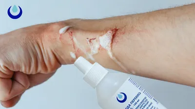 Опасный паразит печени поможет быстрее заживлять кожные раны - Индикатор